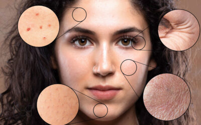 Skin Care Anti Stress